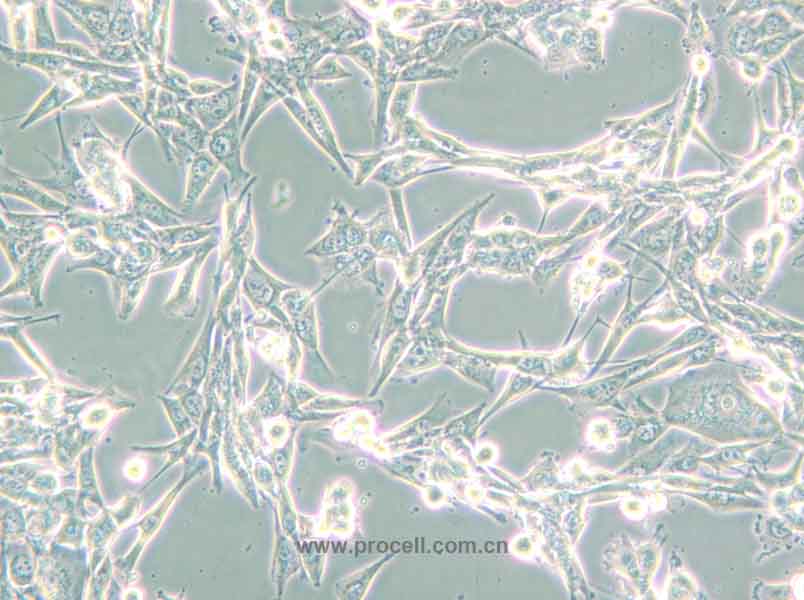 NCI-H1975 (人肺腺癌细胞) (STR鉴定正确)