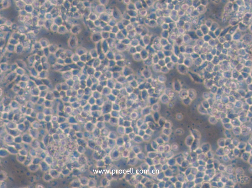 Hce-8693 (人盲肠腺癌细胞(未分化)) (STR鉴定正确)