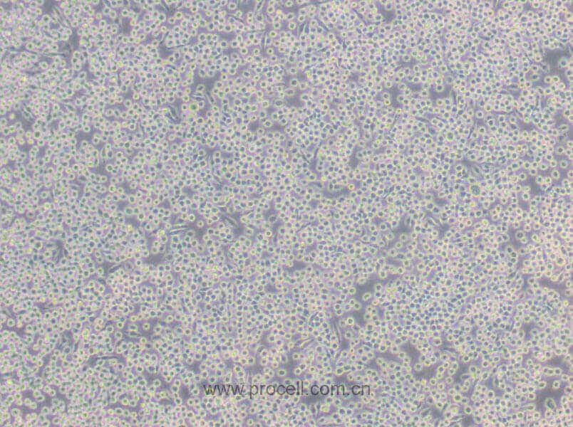 J774A.1 (小鼠单核巨噬细胞) (STR鉴定正确)