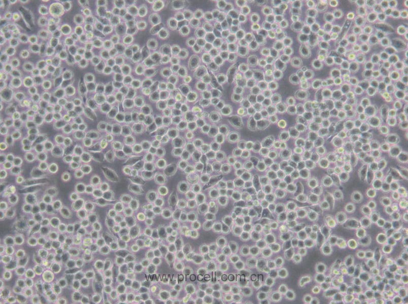 J774A.1 (小鼠单核巨噬细胞) (STR鉴定正确)