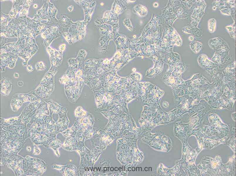 MDA-MB-175VII (人乳腺导管癌细胞)  (STR鉴定正确)