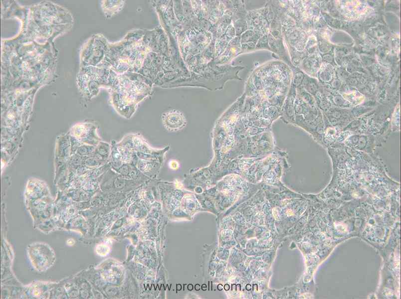 MDA-MB-175VII (人乳腺导管癌细胞)  (STR鉴定正确)