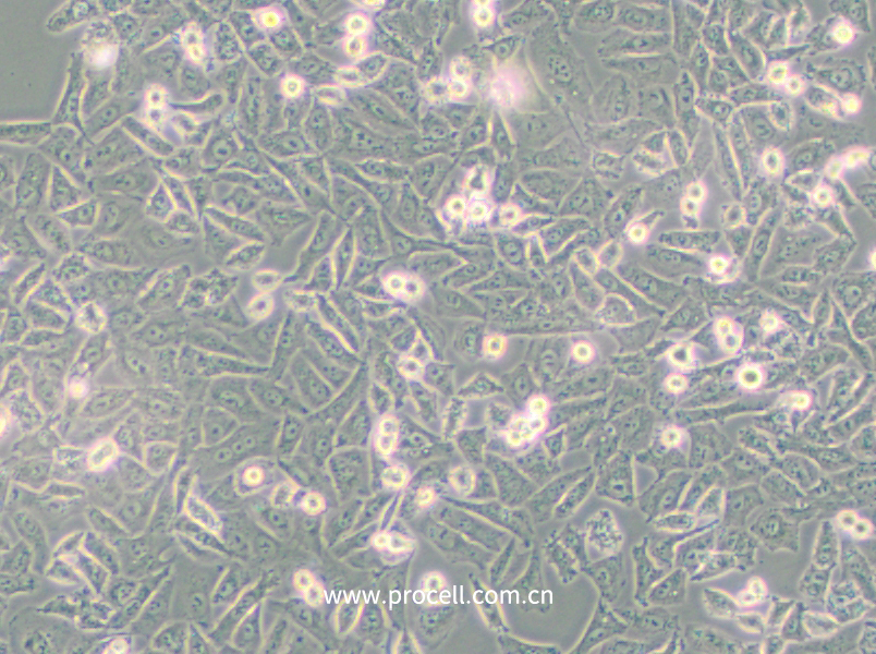 NCI-H1703 (人肺鳞癌细胞) (STR鉴定正确)