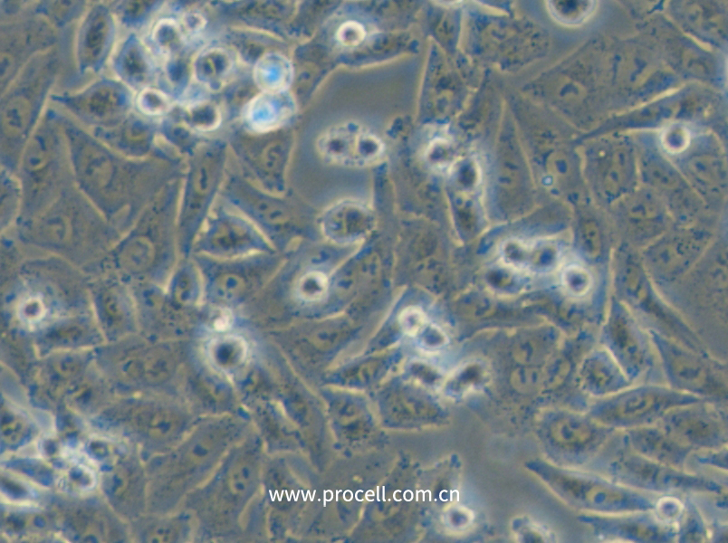 NCI-H1703 (人肺鳞癌细胞) (STR鉴定正确)