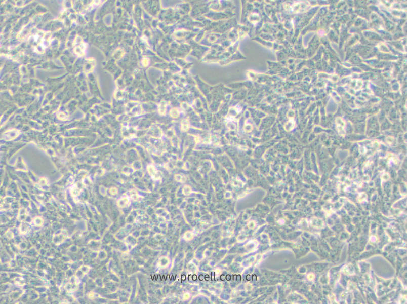 NCI-H295R (人肾上腺皮质腺癌细胞) (STR鉴定正确)