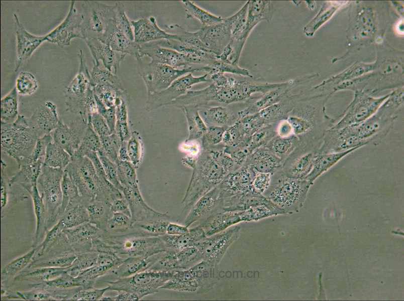 WPMY-1 (人正常前列腺基质永生化细胞) (STR鉴定正确)