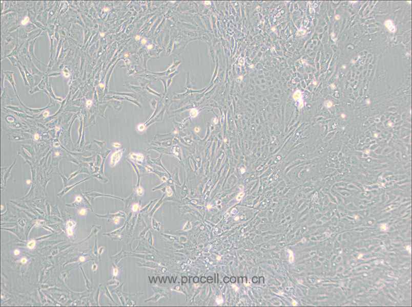 Pt K1 [NBL-3] (袋鼠肾细胞) (种属鉴定正确)