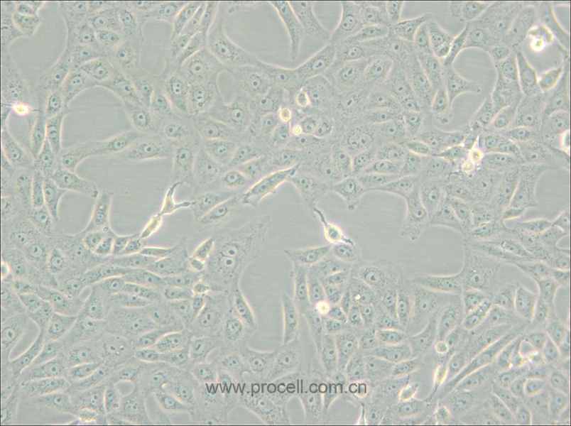 MA-104 [MA 104; MA104] (非洲绿猴胚胎肾细胞)(种属鉴定正确)