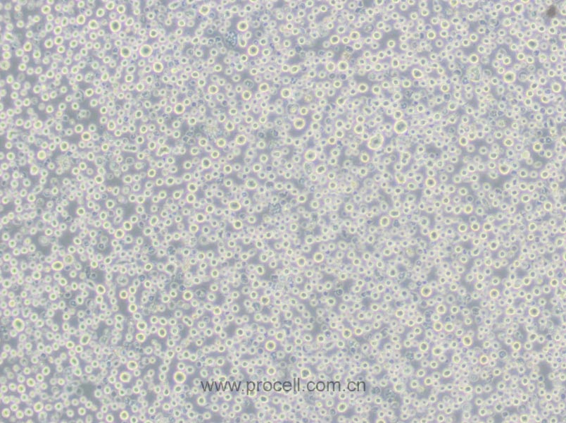 U266 [U266B1] (人多发性骨髓瘤细胞) (STR鉴定正确)