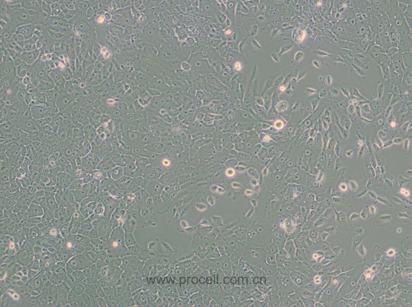 MCF 10A (人正常乳腺上皮细胞) (STR鉴定正确)