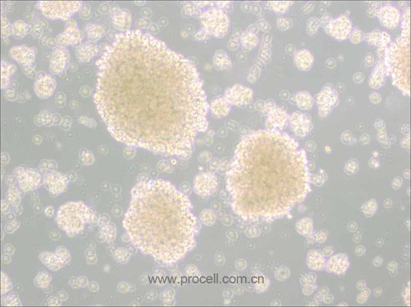 NK-92MI (人恶性非霍奇金淋巴瘤患者的自然杀伤细胞) (STR鉴定正确)
