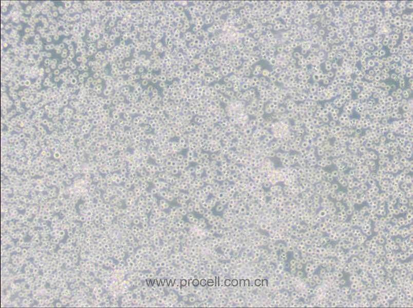 JM (人T淋巴细胞白血病细胞) (STR鉴定)