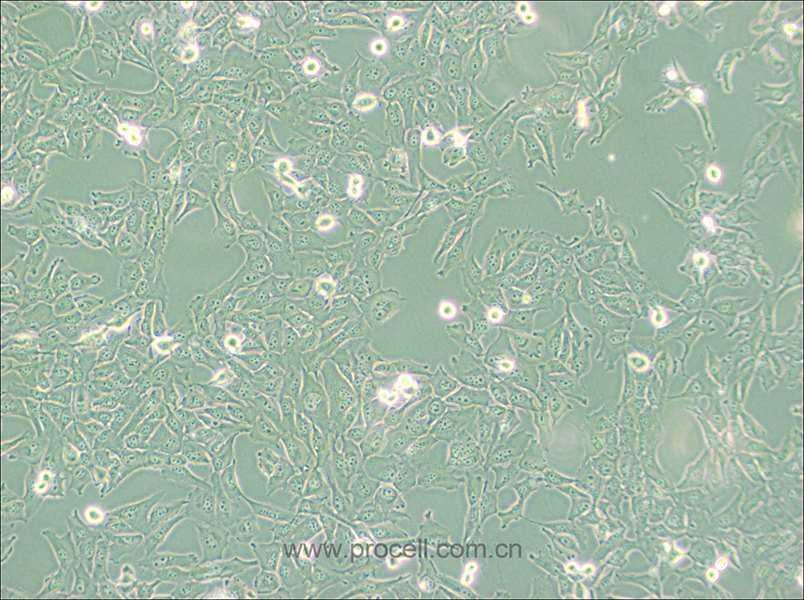 KMH-2 (人甲状腺癌细胞(未分化)) (STR鉴定正确)