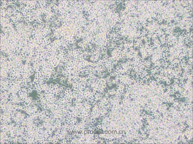 MIA PaCa-2 (人胰腺癌细胞) (STR鉴定正确)