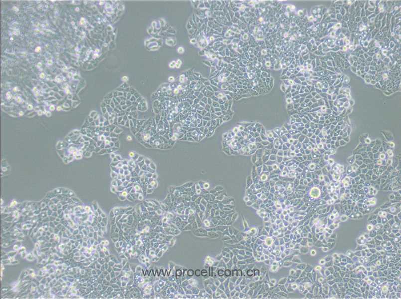 CX-1 (人结肠癌细胞) (STR鉴定正确)