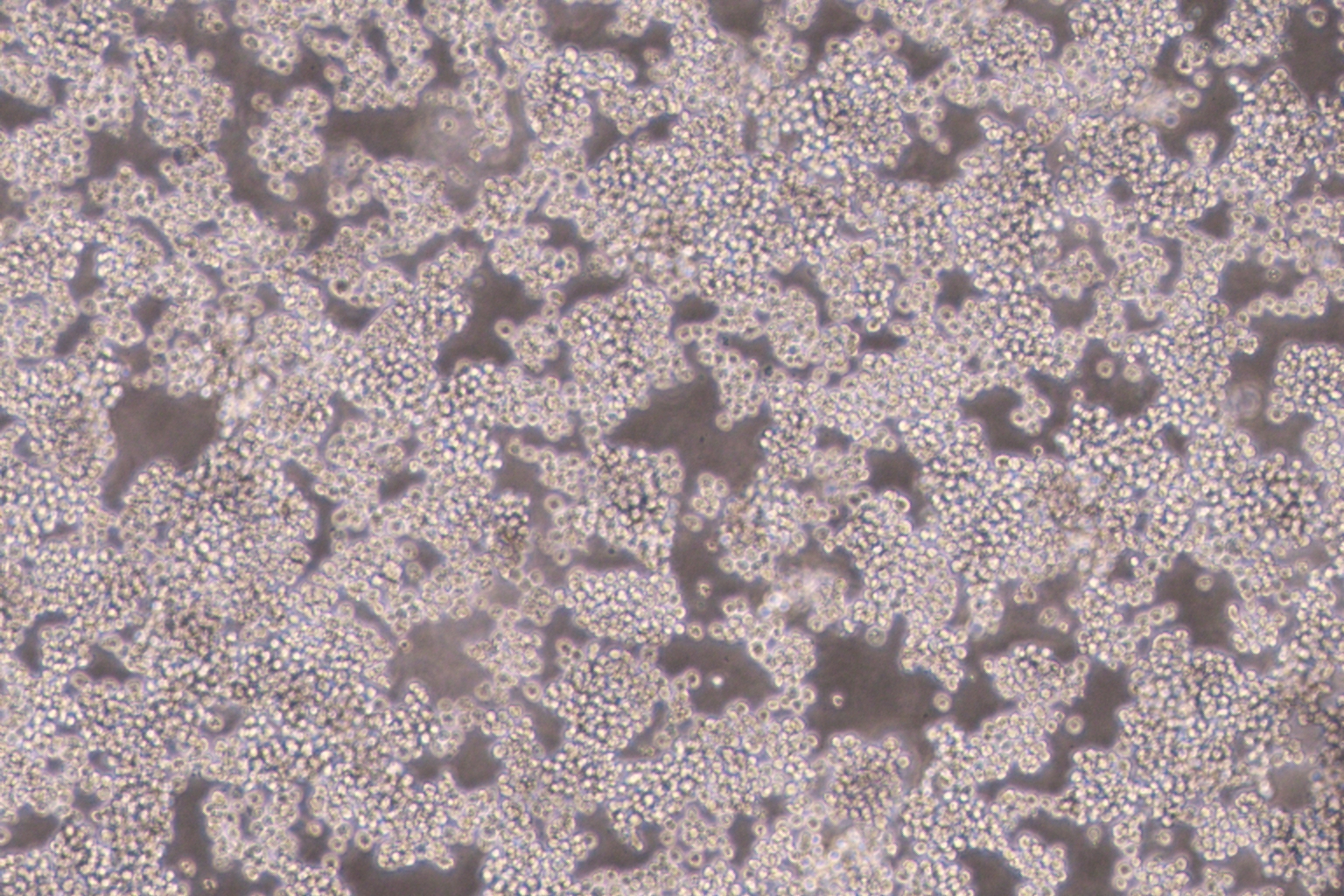 NB4 (人急性早幼粒细胞白血病细胞) (STR鉴定正确)