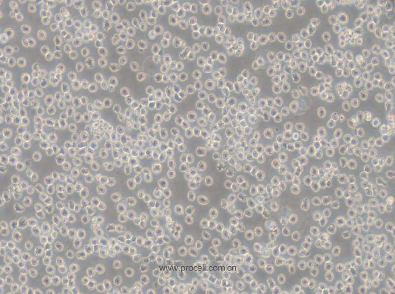 NALM-6 (人B淋巴白血病细胞) (STR鉴定正确)