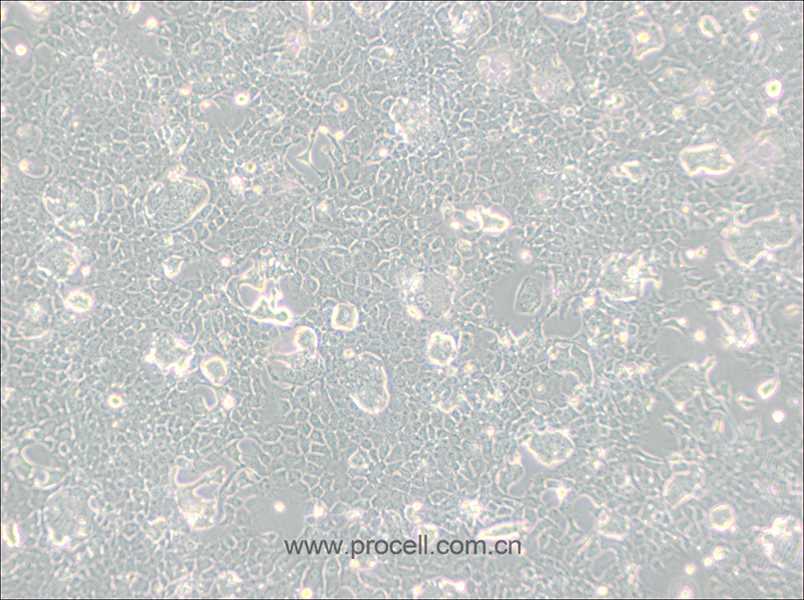 NCI-H508[H508] (人结肠直肠腺癌细胞) (STR鉴定正确)
