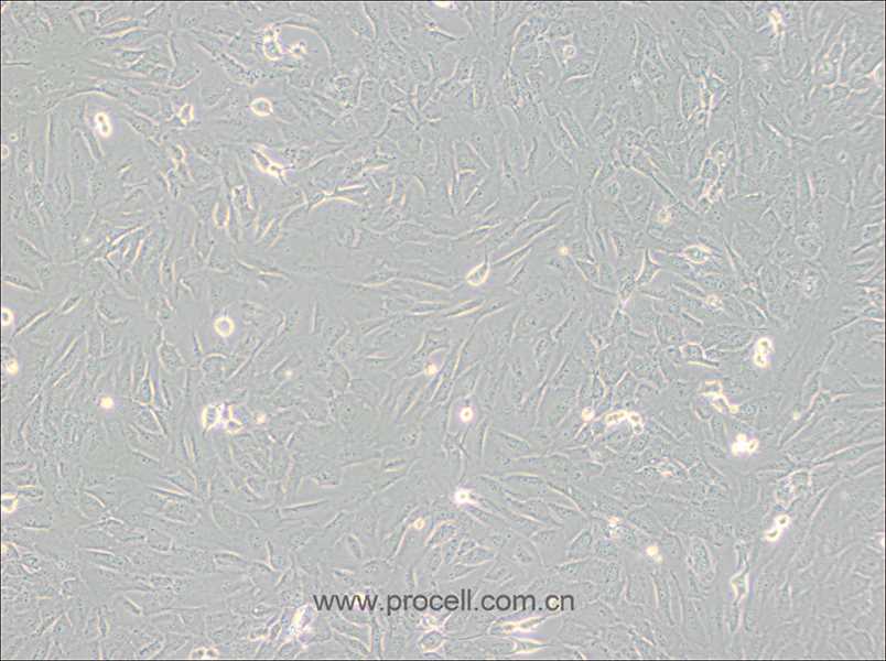 SJSA-1 (人骨肉瘤细胞) (STR鉴定正确)