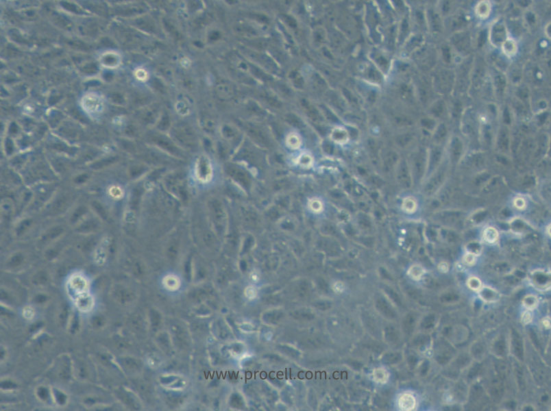 HuCC-T1 (人胆管癌细胞) (STR鉴定正确)