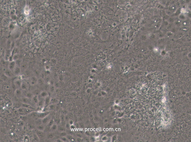 SW1463 (人大肠癌细胞) (STR鉴定正确)
