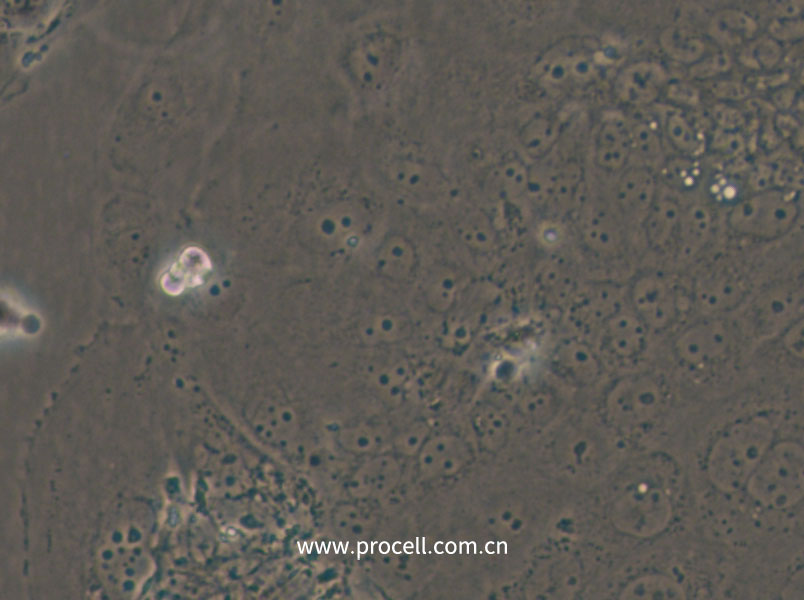 SW1463 (人大肠癌细胞) (STR鉴定正确)