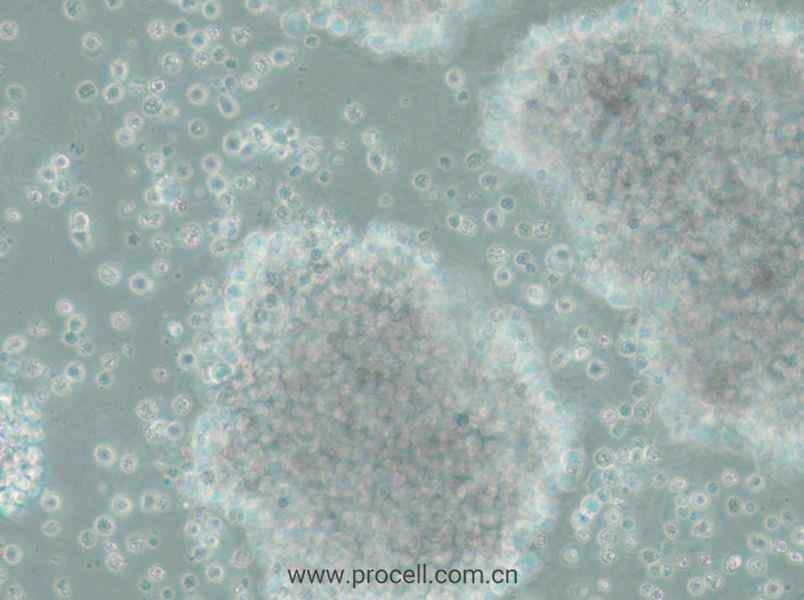 SU-DHL-10 (人B细胞淋巴瘤细胞) (STR鉴定正确)
