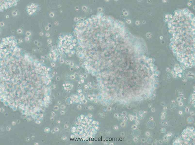 SU-DHL-10 (人B细胞淋巴瘤细胞) (STR鉴定正确)