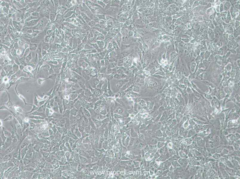 NCI-H2009 (人肺腺癌细胞) (STR鉴定正确)