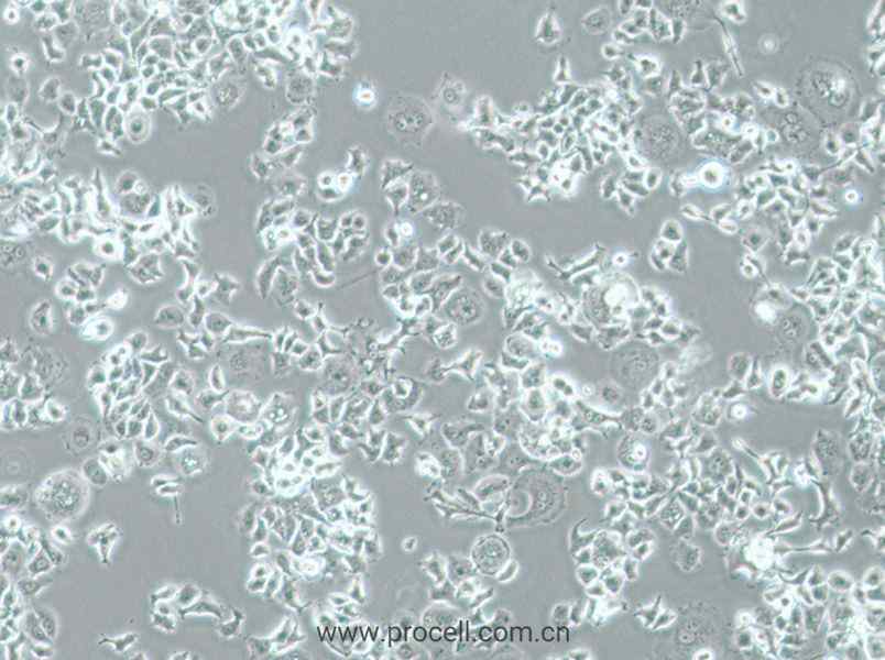NCI-H727 (人肺癌细胞) (STR鉴定正确)