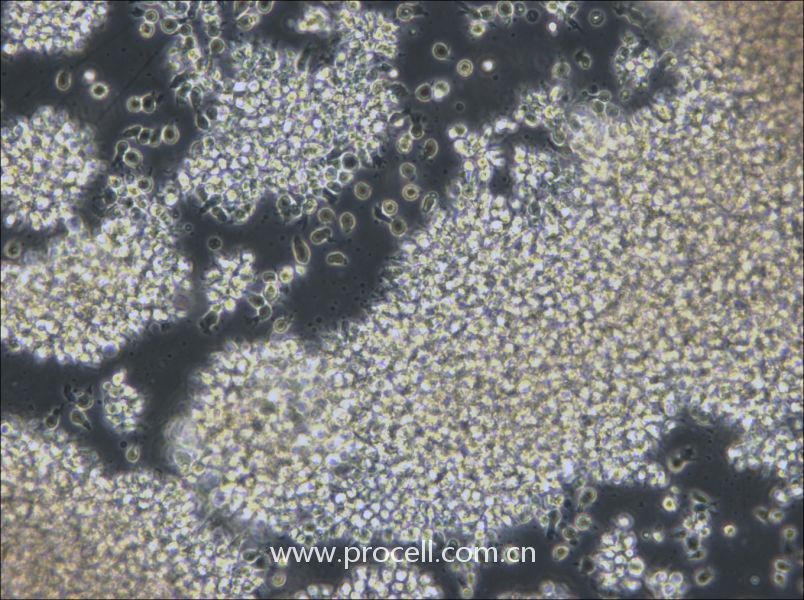 NCI-BL2009 (人淋巴母细胞（EBV 转化）) (STR鉴定正确)