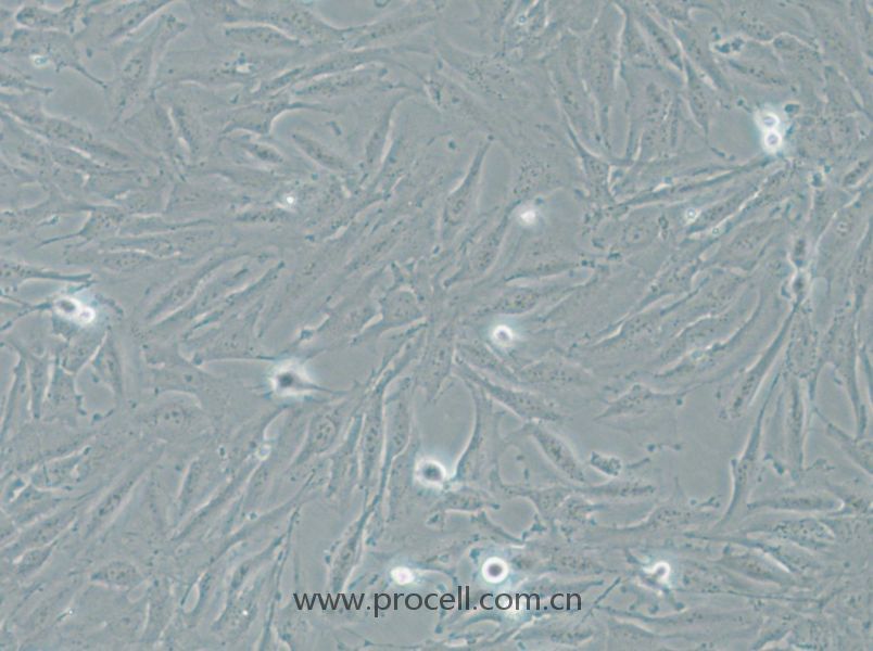 THLE-2 (人肝永生化细胞) (STR鉴定正确)