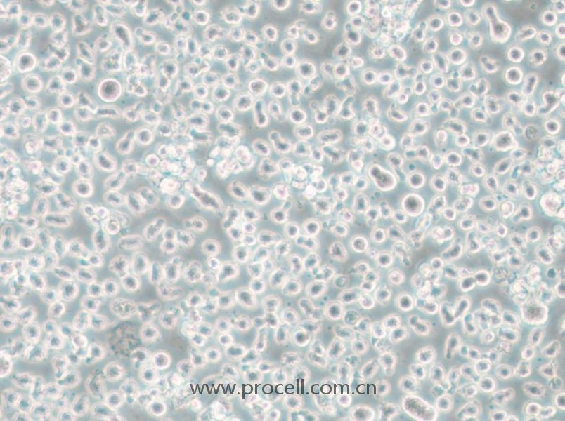 Mono-Mac-6 (人急性单核细胞白血病细胞) (STR鉴定正确)