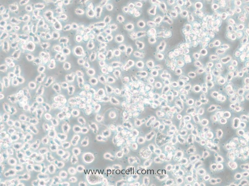 Mono-Mac-6 (人急性单核细胞白血病细胞) (STR鉴定正确)