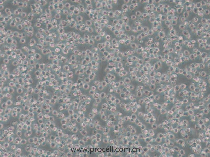 OCI-AML-3 (人急性髓细胞性白血病细胞) (STR鉴定正确)