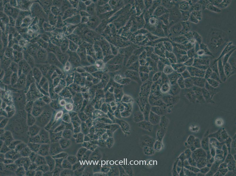 NCI-H522[H522] (人非小细胞肺癌细胞) (STR鉴定正确)