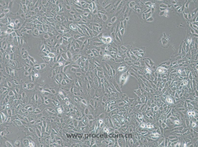 NCI-H1666 (人肺支气管癌细胞) (STR鉴定正确)