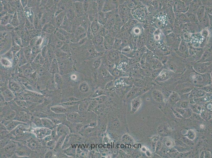 NCI-H1666 (人肺支气管癌细胞) (STR鉴定正确)