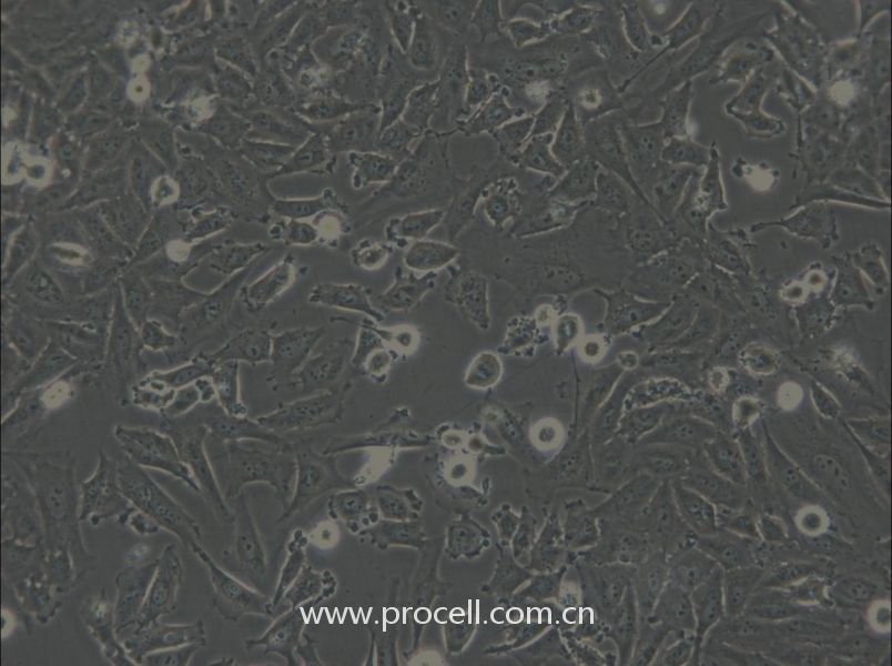 LN-18 (人胶质母细胞瘤) (STR鉴定正确)