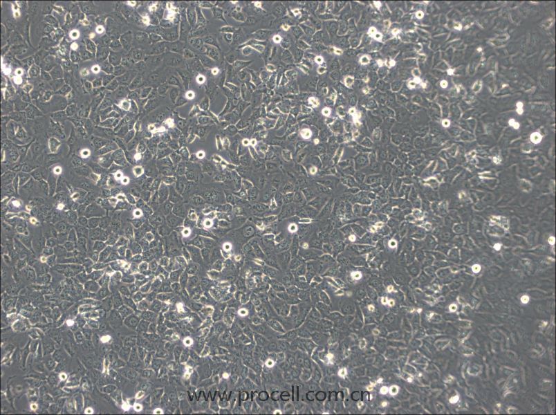 BPH-1 (人前列腺增生细胞) (STR鉴定正确)
