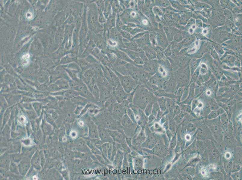 SW1271 (人小细胞肺癌细胞) (STR鉴定正确)
