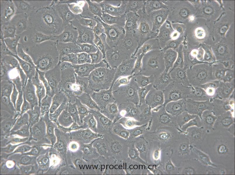 HSC2 (人口腔鳞状肿瘤细胞) (STR鉴定正确)