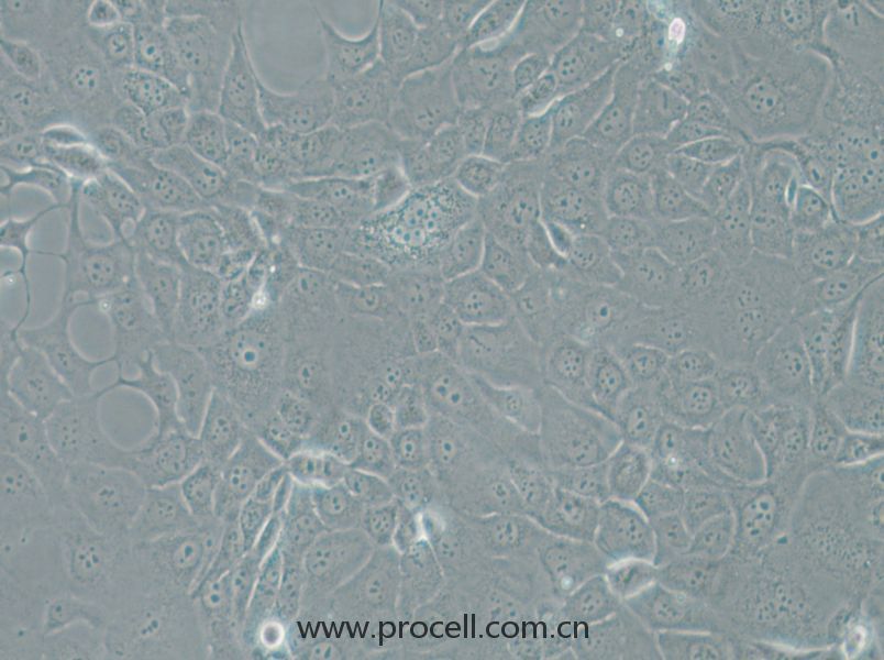 HCC-78 (人肺腺癌细胞) (STR鉴定正确)