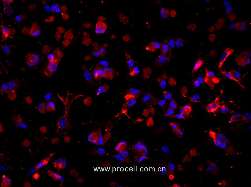 小鼠肝星状细胞