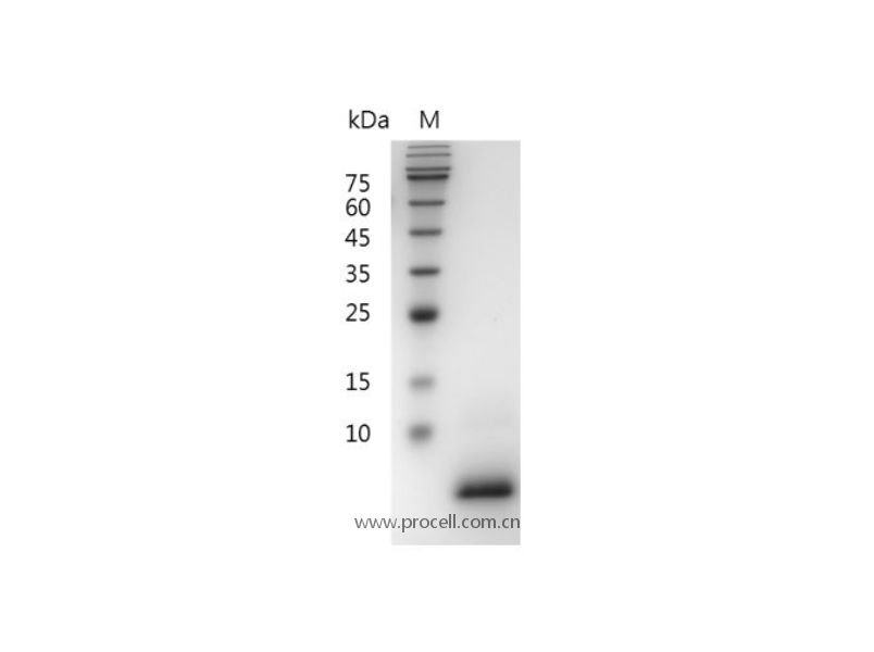 EGF/Urogastrone/URG, Mouse, Recombinant