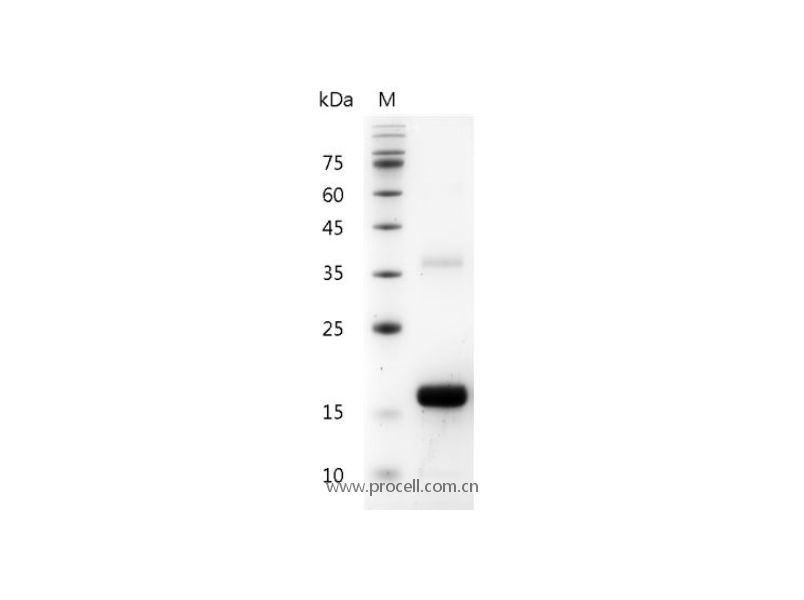 IL-2/TCGF/Aldesleukin, Mouse, Recombinant