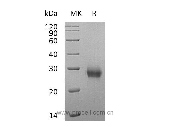 RANK/ TNFRSF11A/ CD265 (C-6His), Human, Recombinant