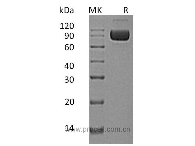 IL-1RAcP/ IL-1R3/ IL-1F6 (C-Fc-6His), Human, Recombinant