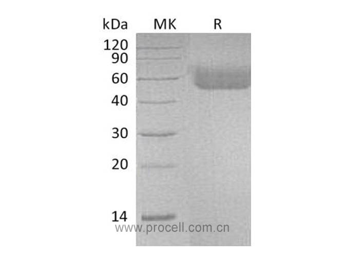 IL-1R-1/ CD121a, Human, Recombinant