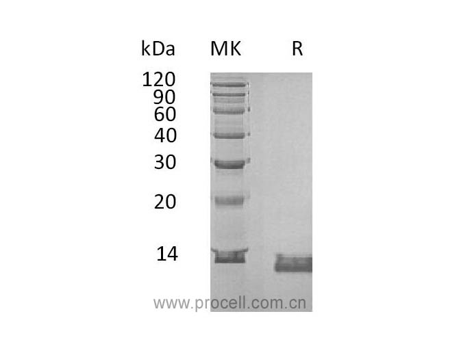 IL-8/ CXCL8 (C-6His), Human, Recombinant